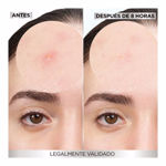Imagen de Parches para Acne Garnier Pimple Patch 8H Invisible