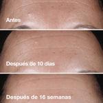 Imagen de Sérum Corrector Arrugas Clinique Smart Clinical Repair 50 ml