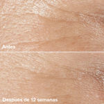 Imagen de Crema Antiarrugas Clinique Smart Clinical Repair 50 ml