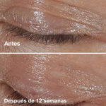 Imagen de Crema Contorno de Ojos Clinique Smart Clinical Repair 15 ml