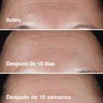 Imagen de Serum Corrector Clinique Smart Clinical Repair 10 ml